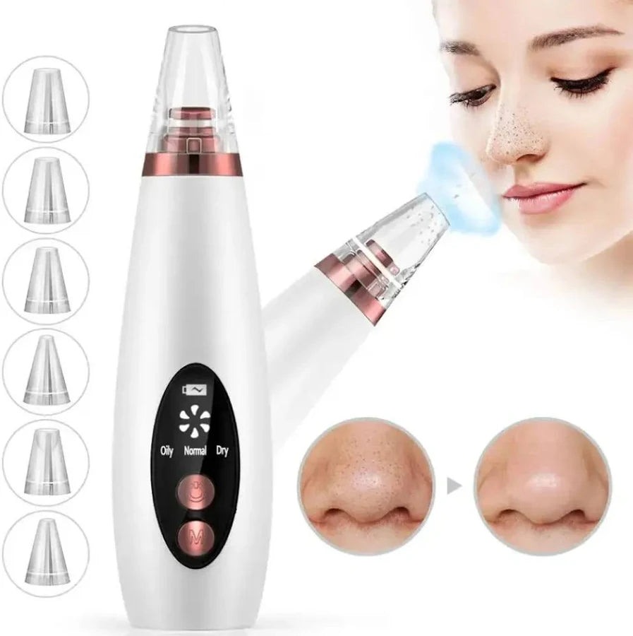 BLACKHEADS REMOVER