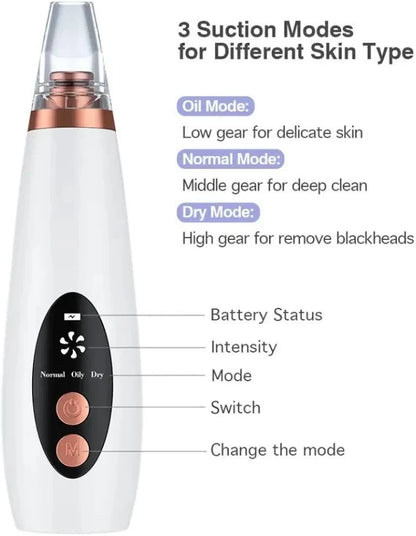 BLACKHEADS REMOVER