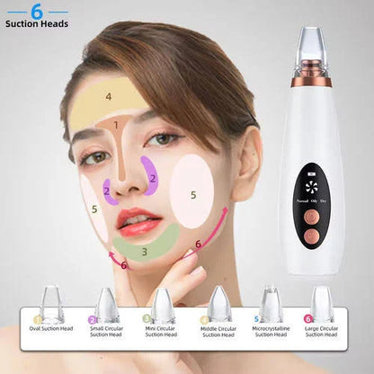 BLACKHEADS REMOVER