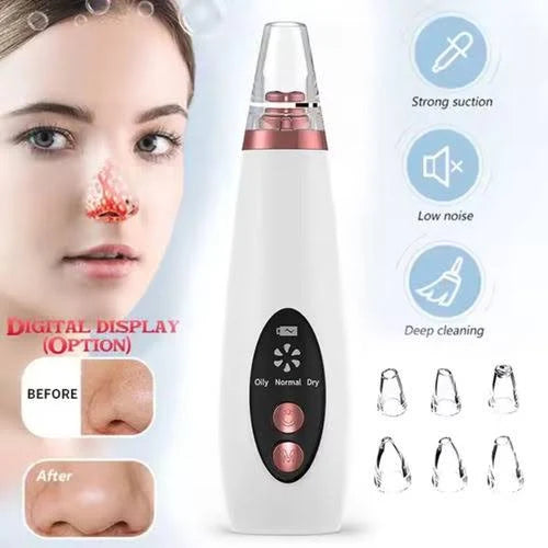 BLACKHEADS REMOVER
