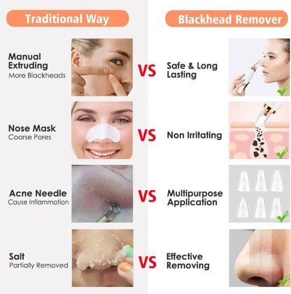 BLACKHEADS REMOVER