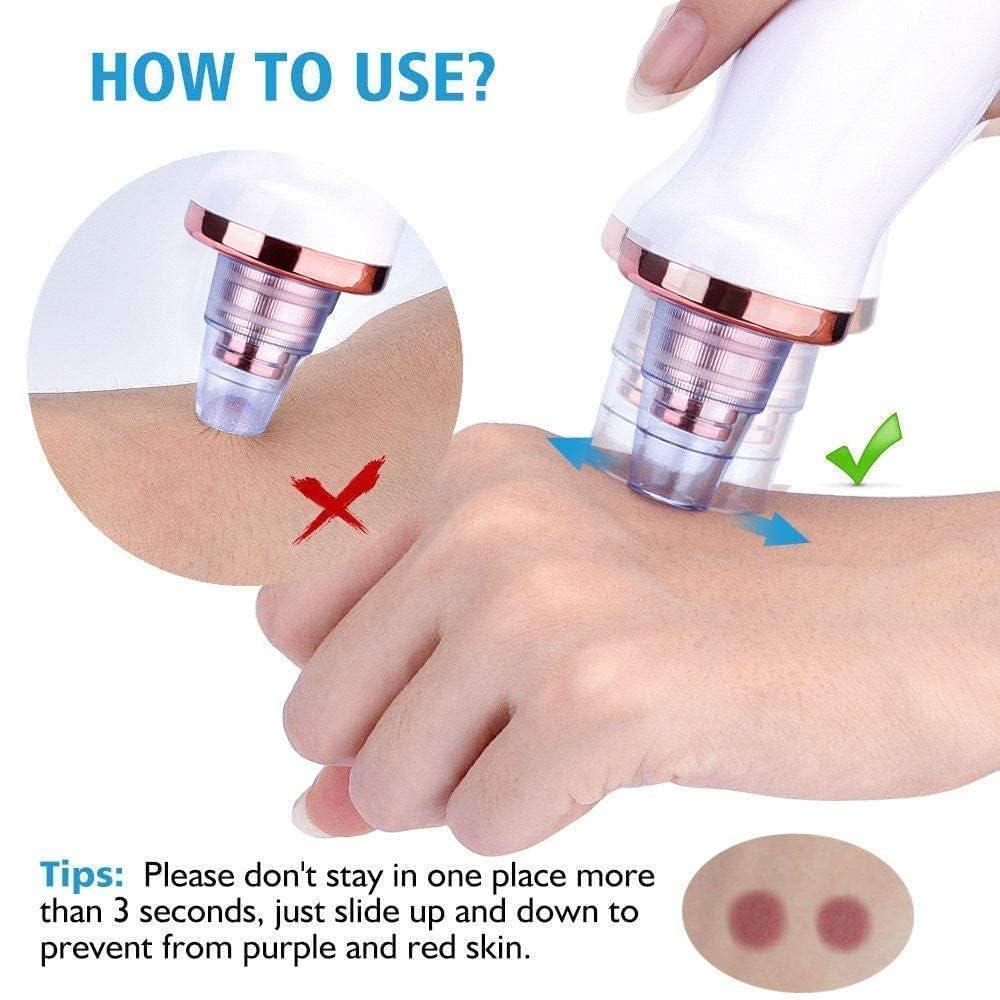 BLACKHEADS REMOVER