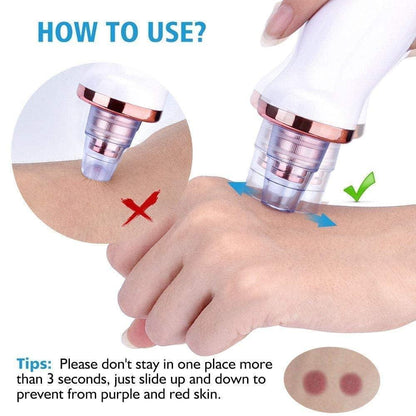 BLACKHEADS REMOVER